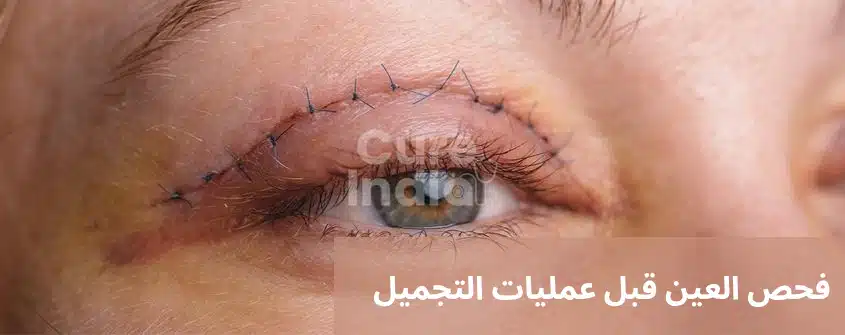 فحص العين قبل عمليات التجميل
