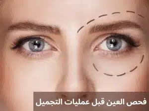 1000300335 المدونة