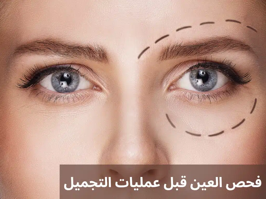 1000300335 فحص العين قبل عمليات التجميل