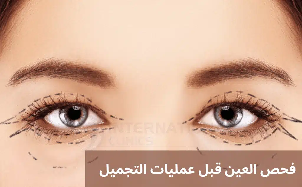 1000300336 فحص العين قبل عمليات التجميل