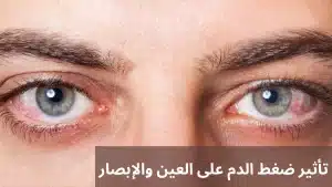 ضغط الدم على العين والإبصار 20250622 170440 0000 المدونة
