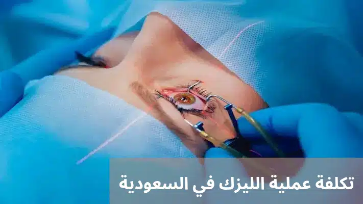 1000300401 تكلفة عملية الليزك في السعودية