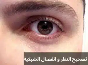 1000300588 المدونة