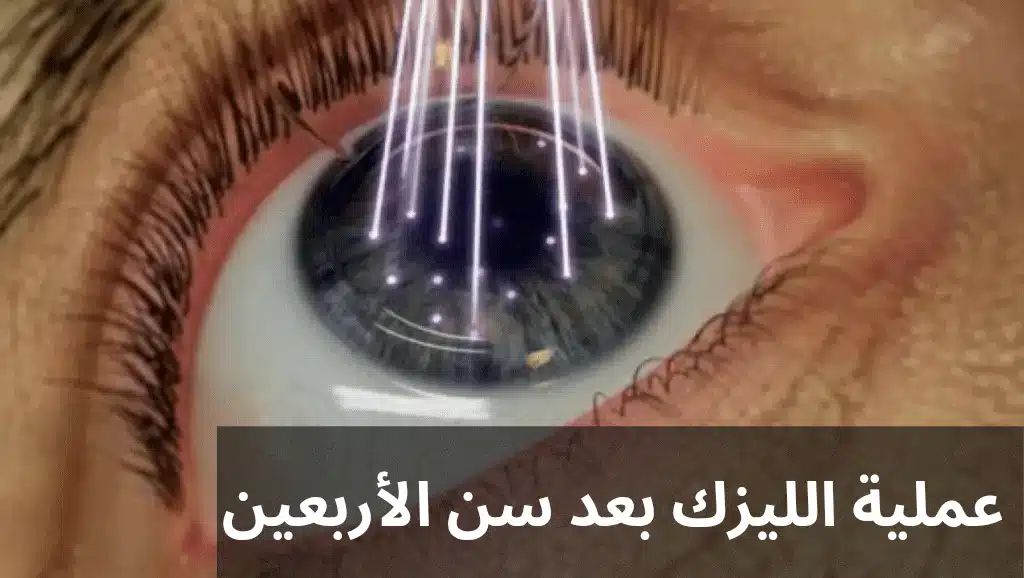 عملية الليزك بعد سن الأربعين
