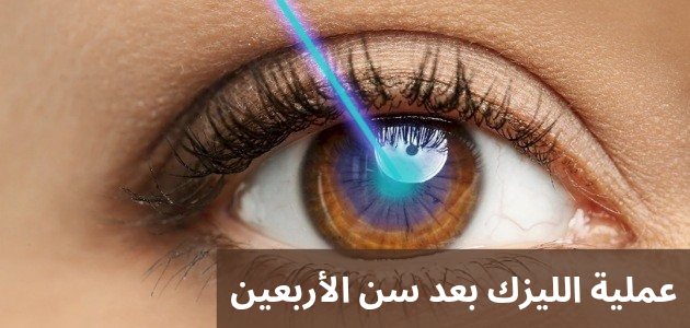 1000301648 عملية الليزك بعد سن الأربعين