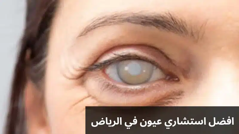 افضل استشاري عيون في الرياض
