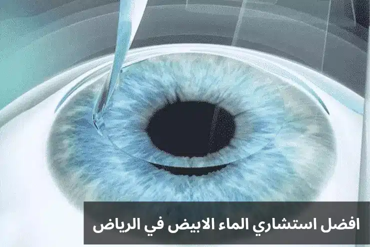 1000303234 افضل استشاري الماء الابيض في الرياض