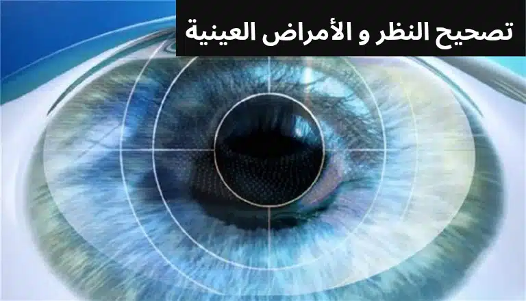1000303460 تصحيح النظر و الأمراض العينية