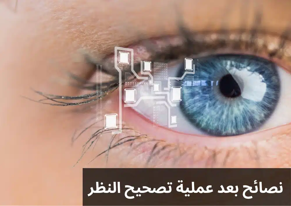 1000303880 نصائح بعد عملية تصحيح النظر