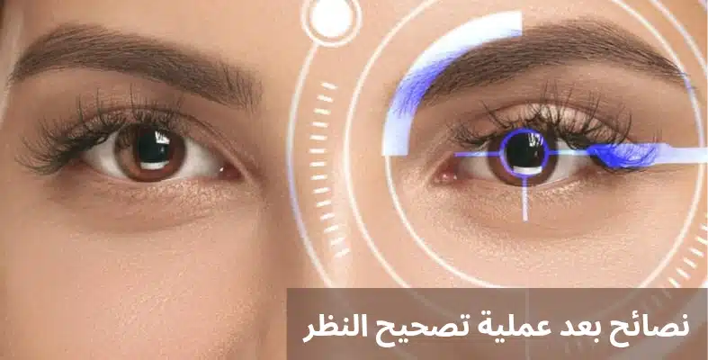 1000303882 نصائح بعد عملية تصحيح النظر