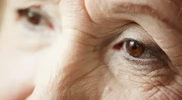 نصائح بعد عملية الماء الابيض