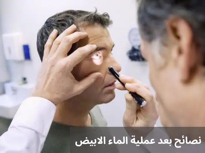 نصائح بعد عملية الماء الابيض
