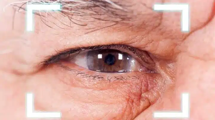 نصائح بعد عملية الماء الابيض
