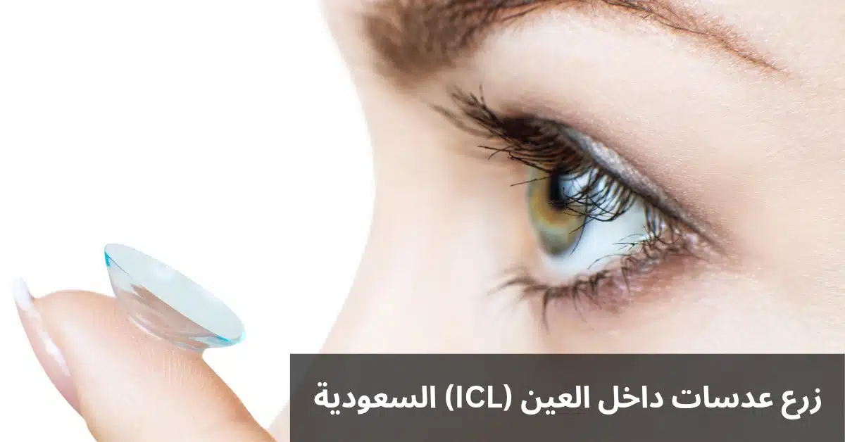 زرع عدسات داخل العين (ICL) السعودية
