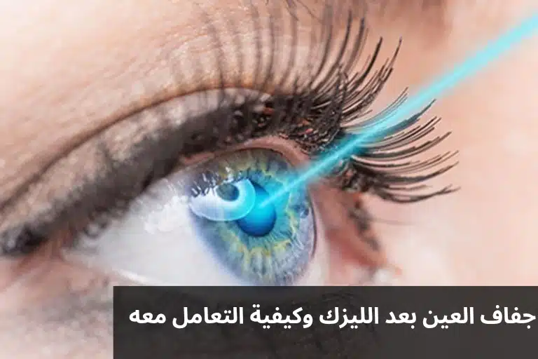 جفاف العين بعد الليزك وكيفية التعامل معه
