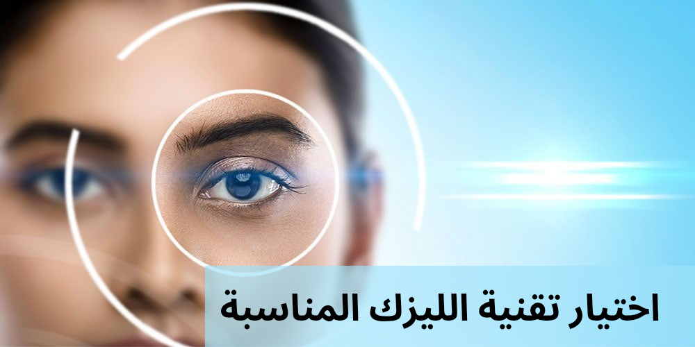 اختيار تقنية الليزك المناسبة
