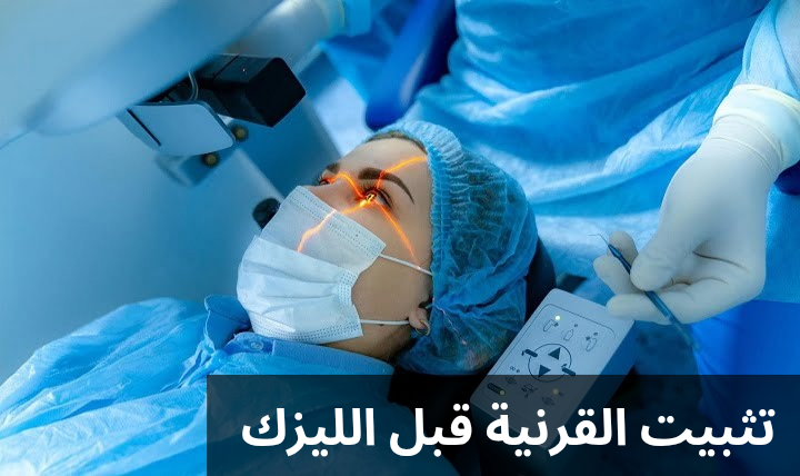 1000306263 تثبيت القرنية قبل الليزك
