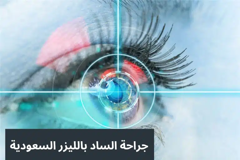 1000306638 جراحة الساد بالليزر السعودية