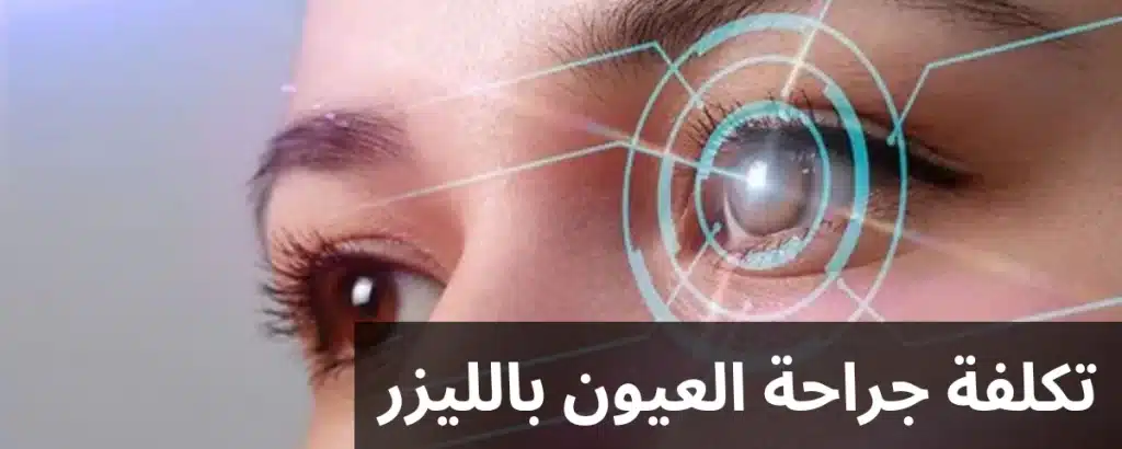 1000306976 تكلفة جراحة العيون بالليزر