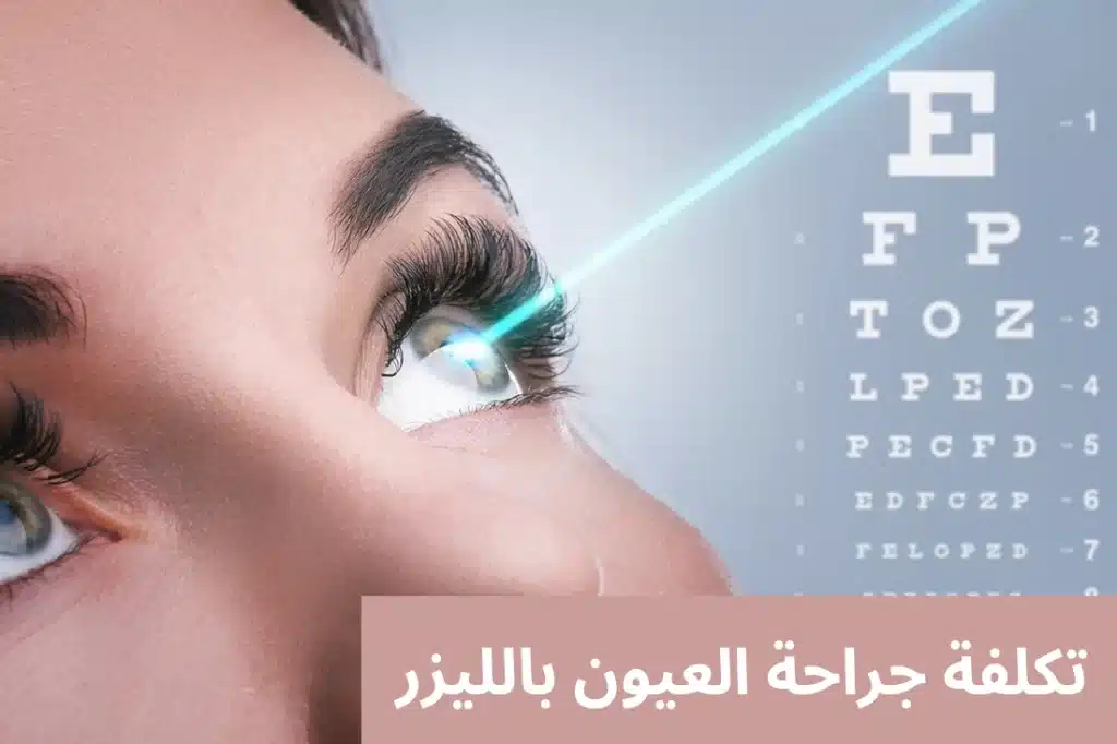 1000306977 تكلفة جراحة العيون بالليزر