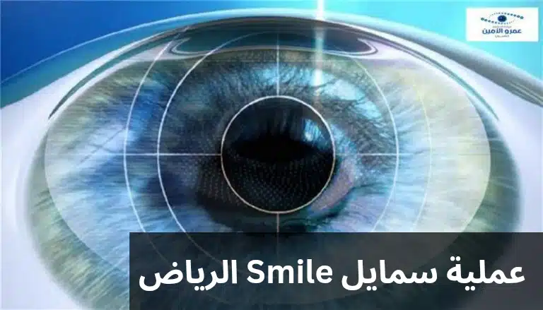 1000307378 عملية سمايل Smile الرياض