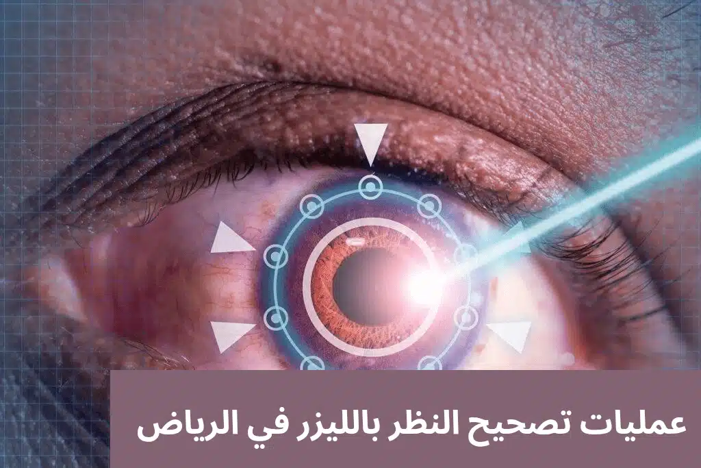 1000307667 عمليات تصحيح النظر بالليزر في الرياض