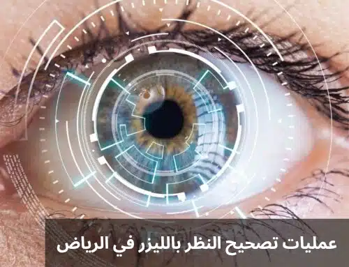 1000307668 عمليات تصحيح النظر بالليزر في الرياض