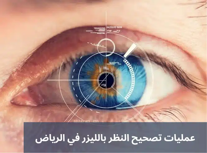 عمليات تصحيح النظر بالليزر في الرياض

