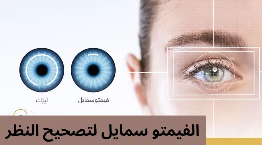 الفيمتو سمايل لتصحيح النظر
