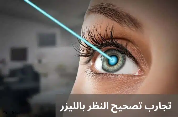 تجارب تصحيح النظر بالليزر
