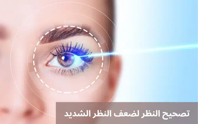 1000309390 تصحيح النظر لضعف النظر الشديد