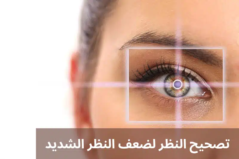 1000309391 تصحيح النظر لضعف النظر الشديد