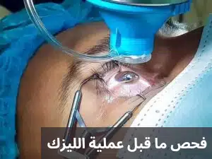 1000309971 فحص ما قبل عملية الليزك