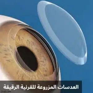 1000310239 المدونة