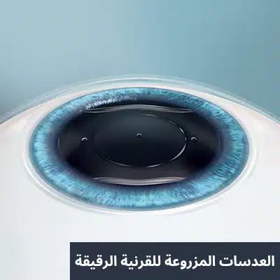 1000310240 العدسات المزروعة للقرنية الرقيقة