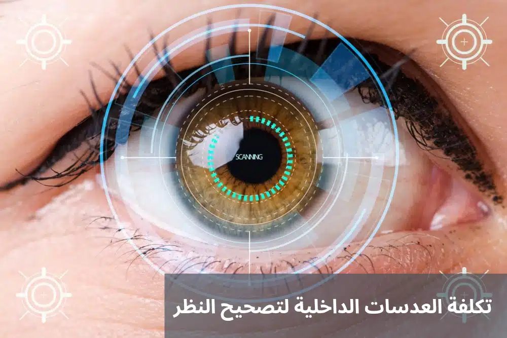 1000311110 تكلفة العدسات الداخلية لتصحيح النظر