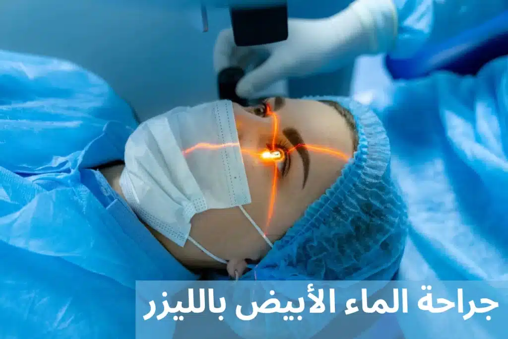 1000311268 جراحة الماء الأبيض بالليزر