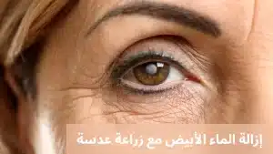 1000311457 المدونة