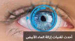 1000313860 المدونة