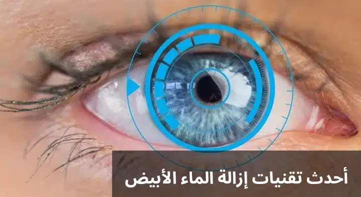 أحدث تقنيات إزالة الماء الأبيض
