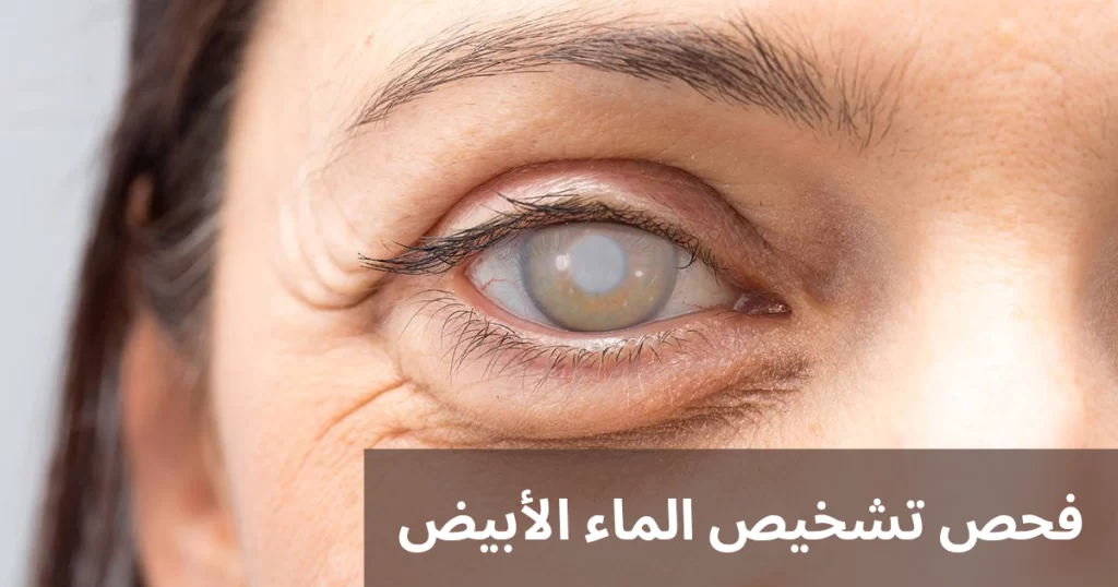 1000314571 فحص تشخيص الماء الأبيض