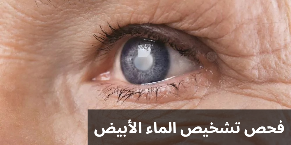 1000314572 فحص تشخيص الماء الأبيض