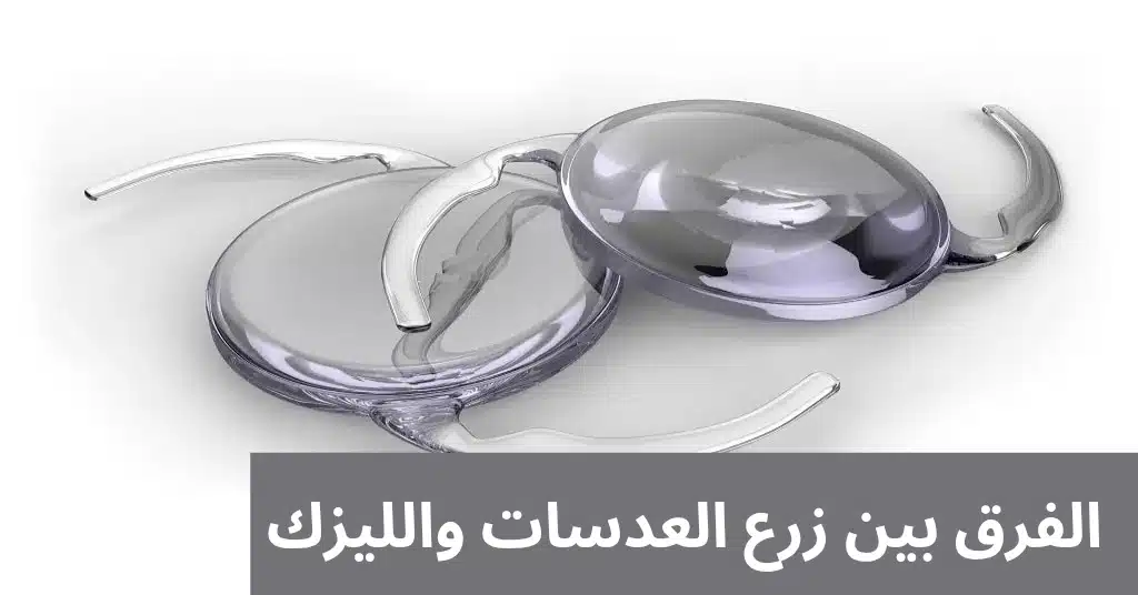 الفرق بين زرع العدسات والليزك