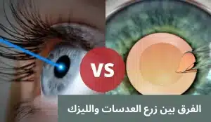 1000319063 المدونة
