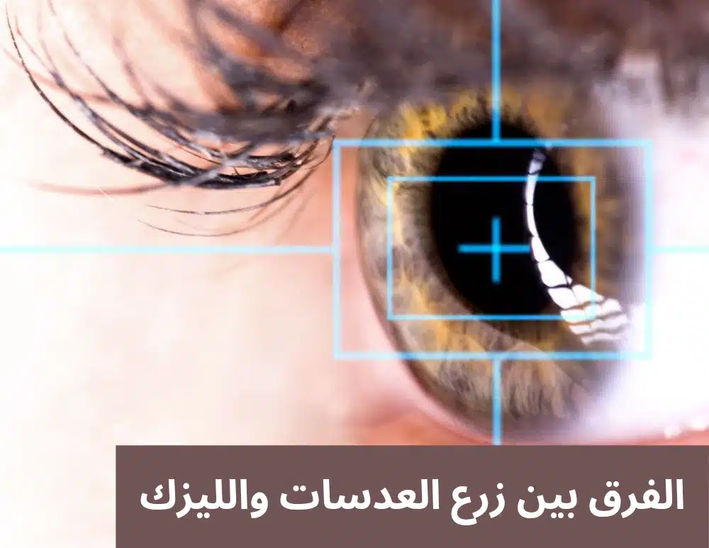 1000319064 الفرق بين زرع العدسات والليزك