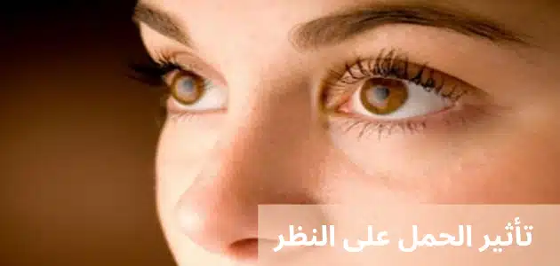 تأثير الحمل على النظر
