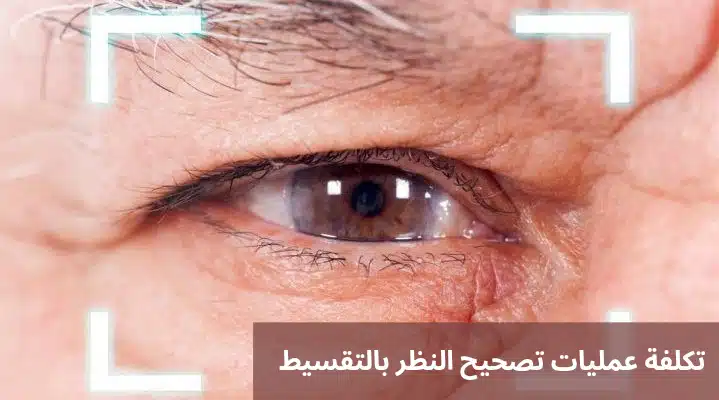 1000327716 تكلفة عمليات تصحيح النظر بالتقسيط