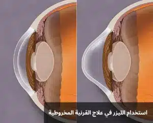 1000329367 المدونة