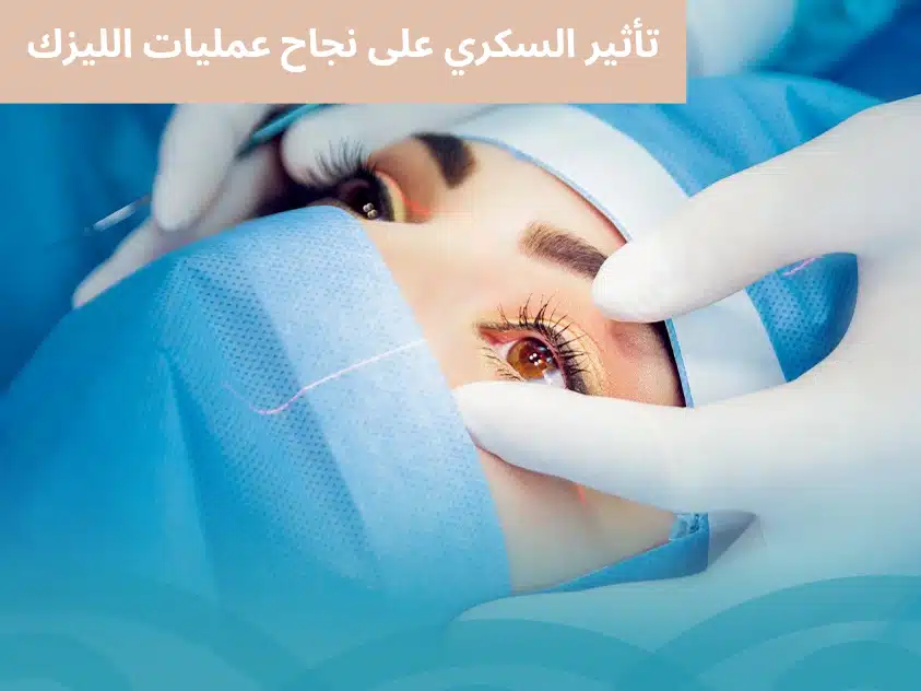 1000332526 تأثير السكري على نجاح عمليات الليزك