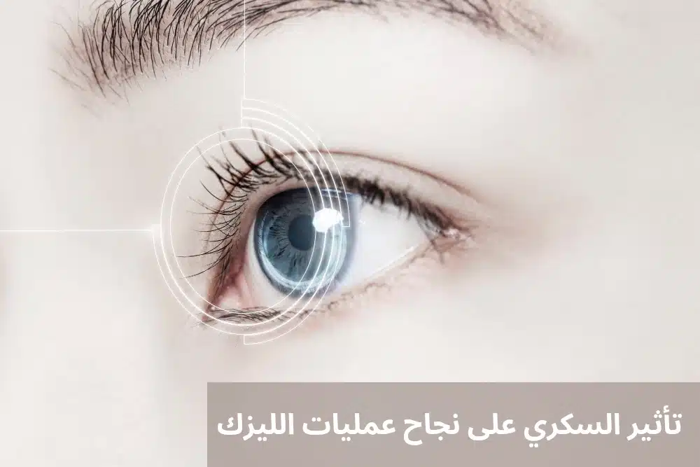 تأثير السكري على نجاح عمليات الليزك
